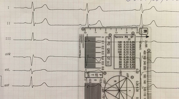holter